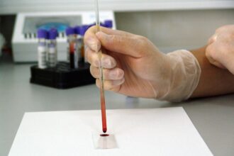Analyzing the Results of Analysis